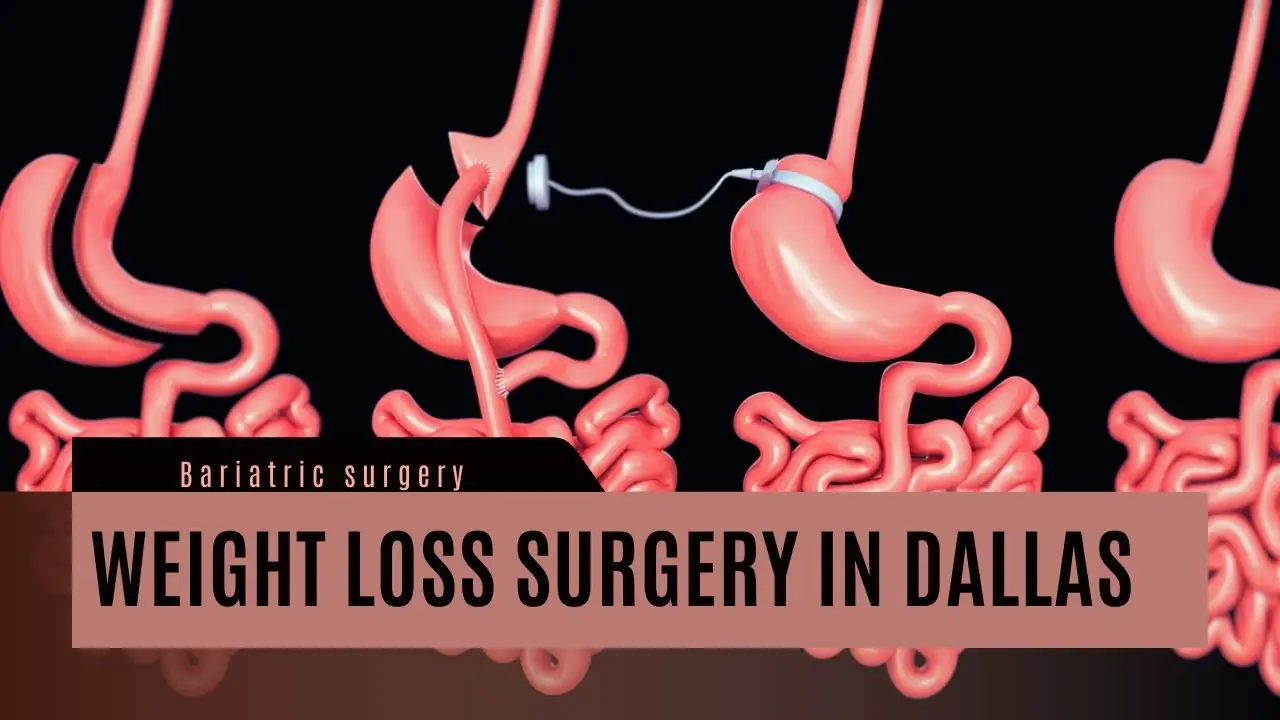 Weight Loss Surgery Dallas, Texas: bariatric surgery